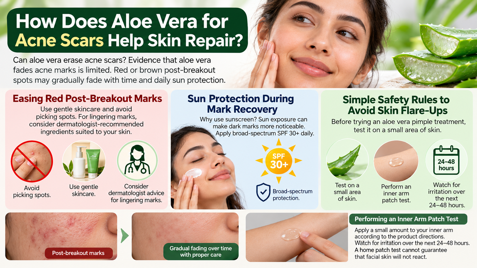 Aloe Vera Acne Scar Care Guide
